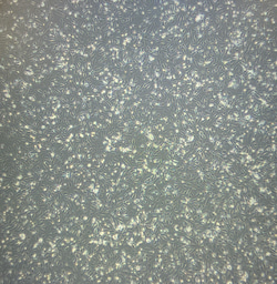Project Outline: Developing a Gastruloid Model from Expanded Potency Stem Cells (EPSCs) to Study Neurodevelopmental Disorders