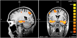 Project Outline: Physiological Responses to Racism-Related Stress and Mental Health Symptoms