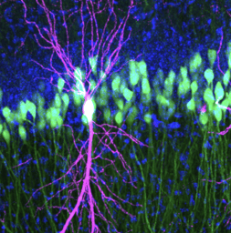 Project Outline: Investigating Activity-Dependent Regulation of Mitochondrial Proteins in Parvalbumin-Positive Interneurons in Adult C57BL6/J Mice