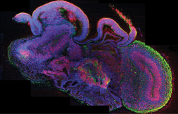 Project Summary - Comparison of Methodologies for Vascularised Brain Organoid Generation