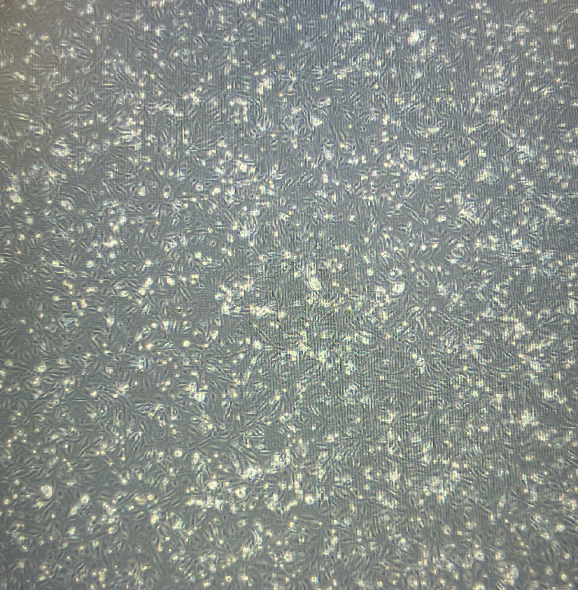 Project Outline: Developing a Gastruloid Model from Expanded Potency Stem Cells (EPSCs) to Study Neurodevelopmental Disorders