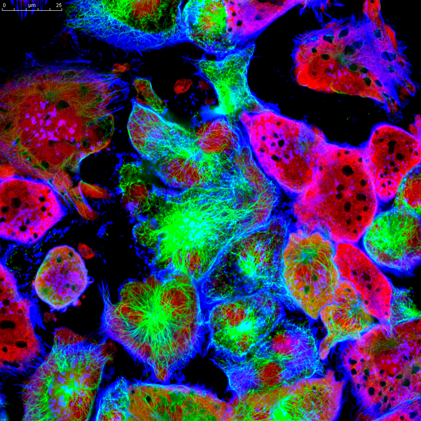 Project: Chemical Inhibition of Autophagy