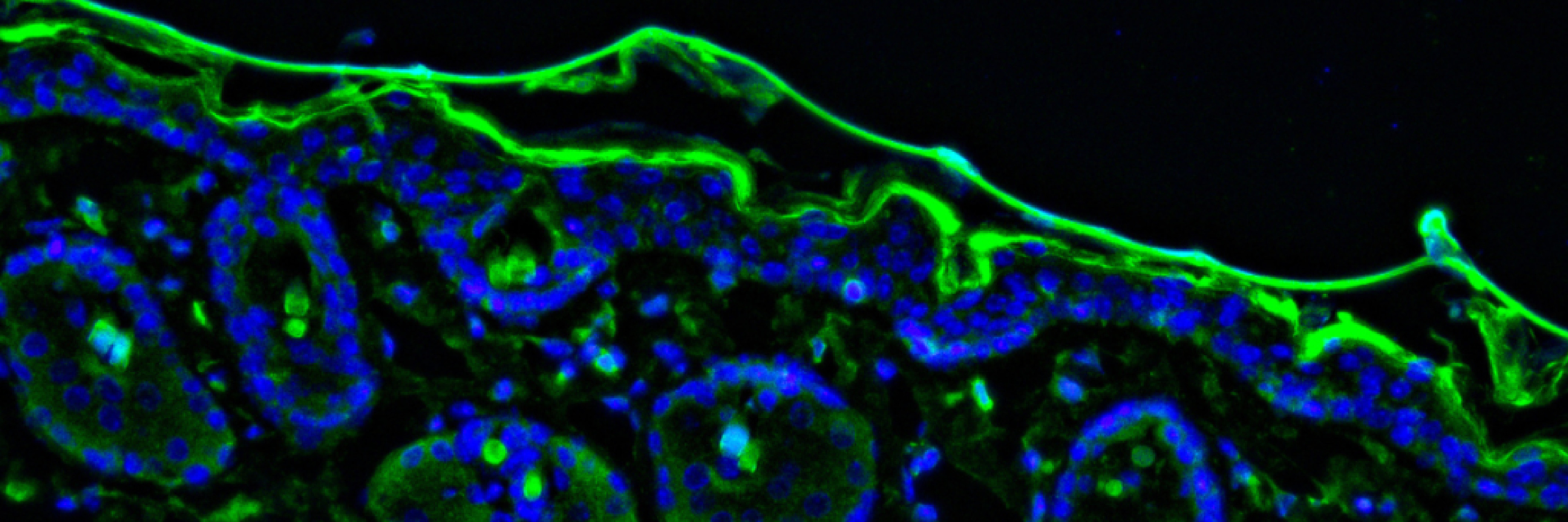 Project Outline: Immune Dysregulation and Parkinson's Disease Pathogenesis