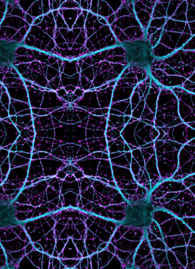 Optimising the Functionalisation of Alginate Hydrogels for Three-dimensional Astrocyte Culture Systems - Poster 